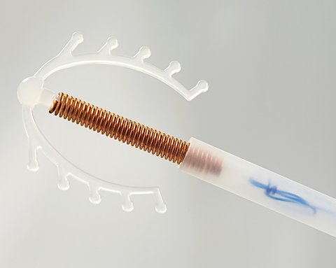 Ilustrasi alat KB IUD atau spiral (iStockphoto)
