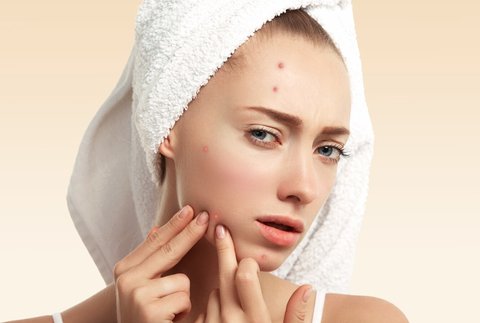 lidah buaya untuk mengobati jerawat