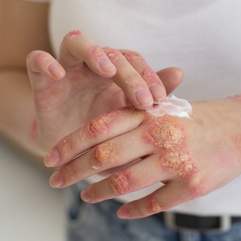 Manfaat Jahe untuk Mengatasi Pencernaan dan Inflamasi