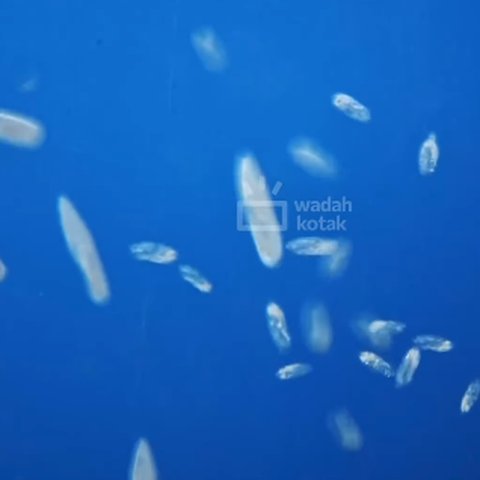 Bakteri di Air Kolam