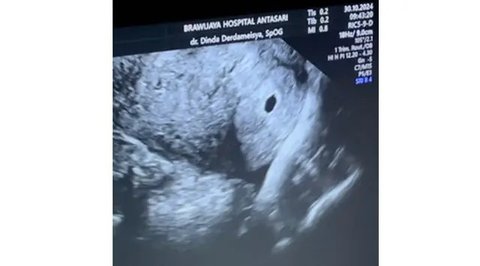Nabila Sudiro anak Tora Sudiro umumkan kehamilan pertama. (sumber: Instagram/muhammadivann)