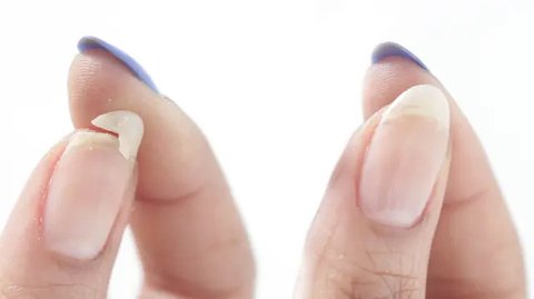 Kantung mata muncul akibat usia, kurang istirahat, atau faktor genetik. Cegah dengan tidur berkualitas, skincare malam, dan perawatan klinis untuk menjaga kulit tetap sehat dan bercahaya. (Il