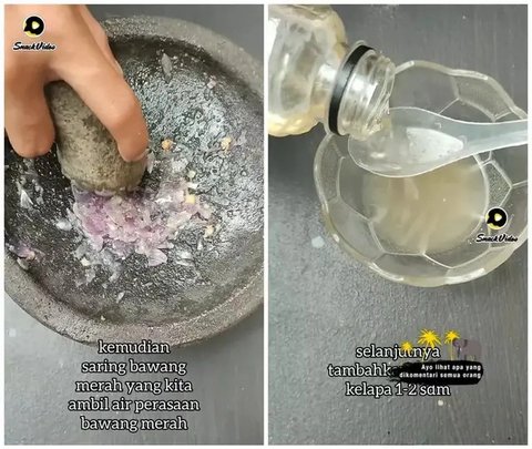 Cara Mengatasi Rambut Rontok, Solusi Mudah dengan 2 Bahan Ini