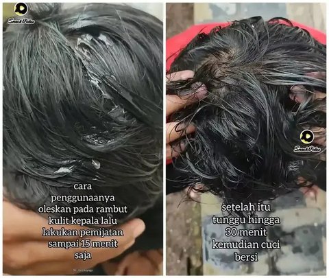 Cara Mengatasi Rambut Rontok, Solusi Mudah dengan 2 Bahan Ini
