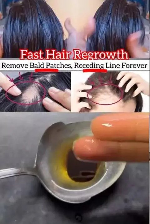 Mengoleskan minyak pada area rambut yang botak (Image by @aribasfoodmood on Tiktok)