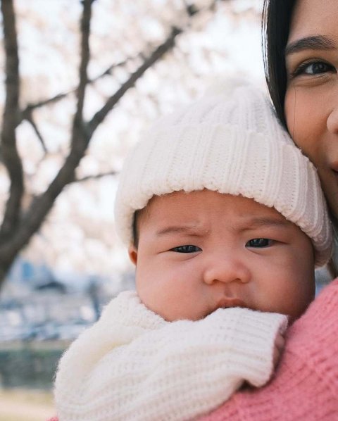 Selain pilihan OOTD-nya yang lucu, pipi tembem baby Noa juga sukses mencuri perhatian dalam setiap jepretan fotonya saat jalan-jalan di taman bunga sakura.