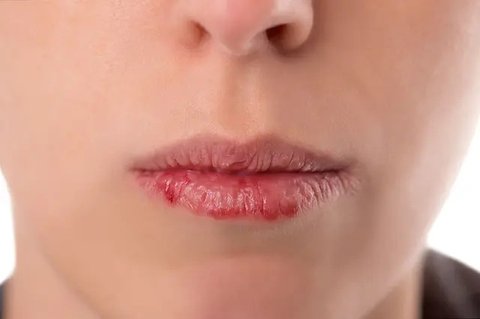 Ilustrasi seorang pria merasa haus dan tenggorokan kering. (Shutterstock/ShotPrime Studio)