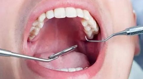 Metode diet menghindari dan menghilangkan konsumsi tambahan gula ataupun alami. (Sumber: Freepik/fabrikasimf).