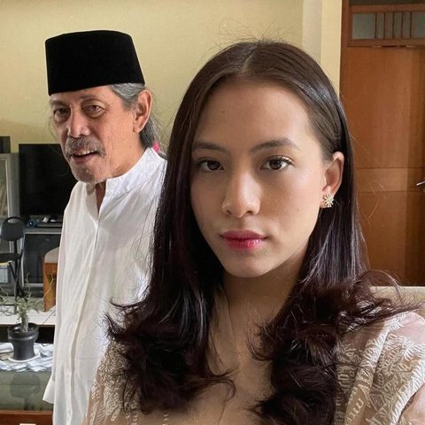 Kabar duka datang dari grup musik legendaris Bimbo. Salah satu personelnya, Raden Darmawan Dajat Hardjakusumah atau Acil Bimbo meninggal dunia. (Foto: Dok. Instagram @zaraadhsty)