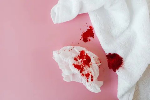 Ilustrasi Mimpi Darah Haid Credit: pexels.com/Saora