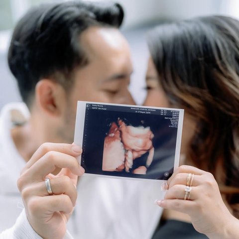 Kiky Saputri Maternity Shoot (instagram/kikysaputrii/windrafotografi).