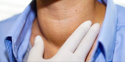 Ganggu Kesehatan dan Penampilan, Ini 7 Cara Mengatasi Gondongan Secara Alami