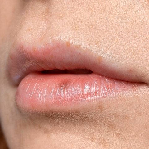 Ilustrasi Bibir Kering