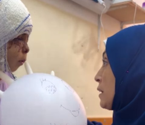 Pilunya Gadis Cilik Gaza Punya Luka Berat di Wajah Usai Serangan Israel