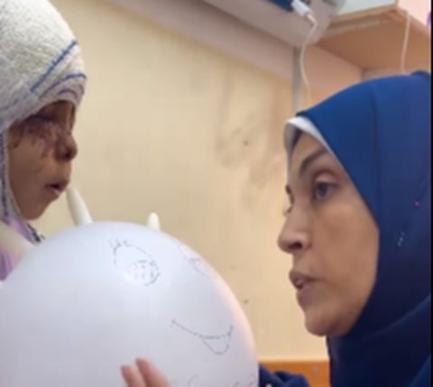 Pilunya Gadis Cilik Gaza Punya Luka Berat di Wajah Usai Serangan Israel