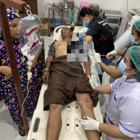 KKB Kembali Tebar Teror di Papua, Kali Ini Warga Dianiaya hingga Leher Luka Robek