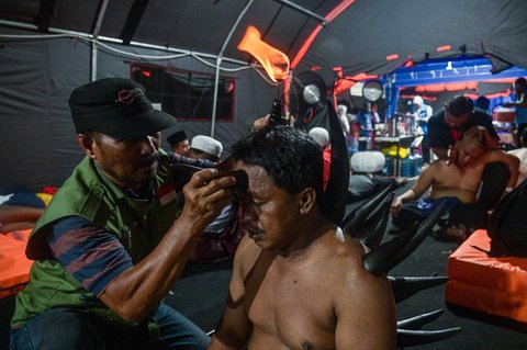 Seorang pria menjalani terapi bekam menggunakan tanduk sapi, yang disediakan oleh para relawan di tenda sementara yang didirikan untuk menampung keluarga santri yang hilang di Rumah Sakit Bhayangkara, Surabaya, Minggu (05/10/2025) malam.