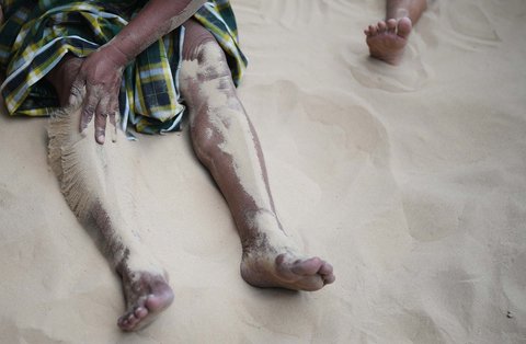 Warga  menutupi kakinya dengan pasir di Desa Legung Timur, Sumenep, Pulau Madura, Indonesia, Selasa (09/09/2025).