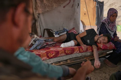 Yassin Marouf (23) berbaring di dalam tenda pengungsian bersama keluarganya di Zawaida, Gaza tengah, Kamis (6/11/2025), setelah kehilangan kaki kiri dan mengalami cedera parah pada kaki kanan akibat serangan artileri Israel pada Mei lalu.