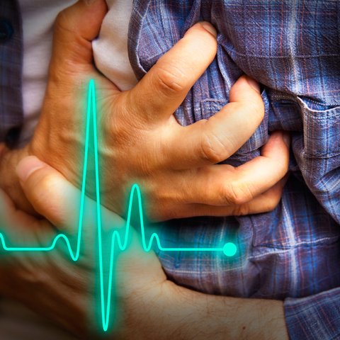 Ilustrasi Serangan jantung (iStockphoto)