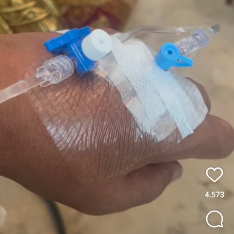 Sempat Buat Khawatir, Begini Kondisi Terbaru Hotman Paris dengan Tangan Diinfus & Alami Demam Tinggi