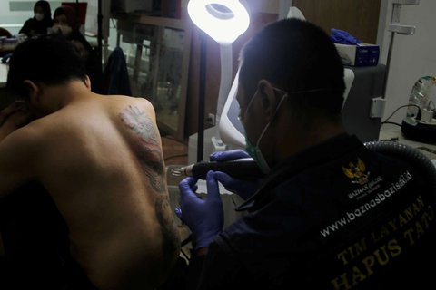 Petugas menggunakan laser untuk menghapus tato seorang pria selama yang mengikuti Layanan Hapus Tato Gratis di Balai Kota DKI Jakarta, Senin (10/3/2025).