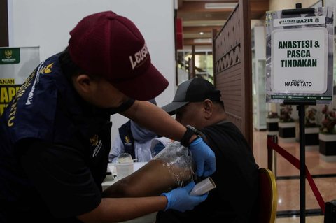 Petugas menggunakan laser untuk menghapus tato seorang pria selama yang mengikuti Layanan Hapus Tato Gratis di Balai Kota DKI Jakarta, Senin (10/3/2025).