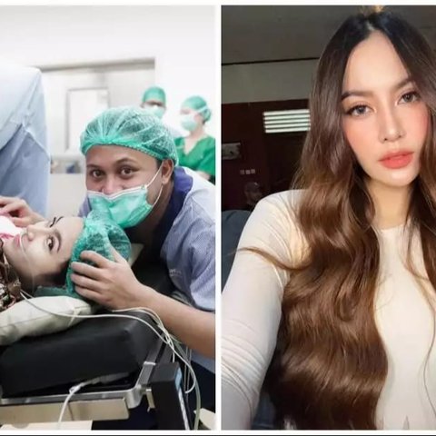 Perbandingan Wajah Bare Face vs Makeup Mahalini