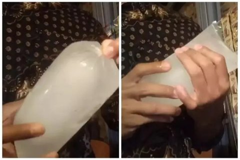 Rasa dingin pada es batu dapat menyamarkan dark circle jika dilakukannya dengan rutin. (Foto: Freepik/Racool_Studio)