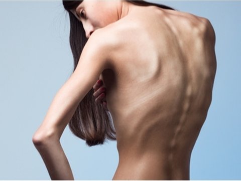  Mengapa Ini Bukan Sekedar Masalah Berat Badan?