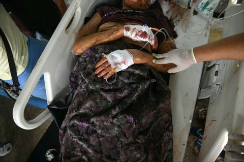 Seorang korban luka mendapatkan perawatan setelah gempa dahsyat berkekuatan magnitudo 7,7 di Kota Naypyidaw, Myanmar, pada Jumat (28/3/2025).