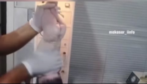 Bayi Baru Lahir Ditampar Berkali-kali oleh Dokter Malah Dipuji Netizen, Ternyata ini yang Terjadi
