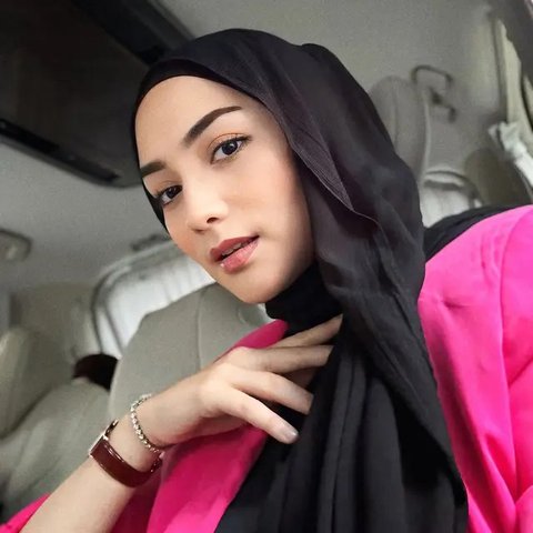 Citra Kirana menajamkan kiprahnya di dunia seni peran lewat film Keajaiban Air Mata Wanita yang dijadwalkan tayang di bioskop mulai 23 Januari 2025. (Foto: Dok. Instagram @citraciki)