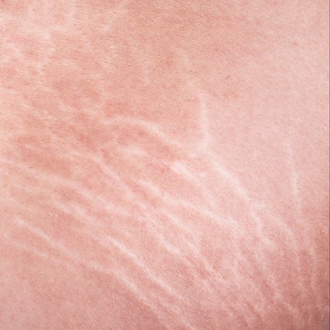 ilustrasi kulit kendur