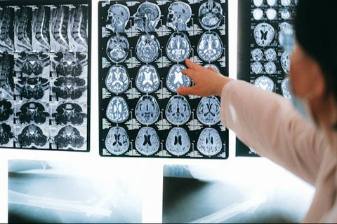 CT Scan atau MRI? Kenali Perbedaan dan Kapan Harus Digunakan
