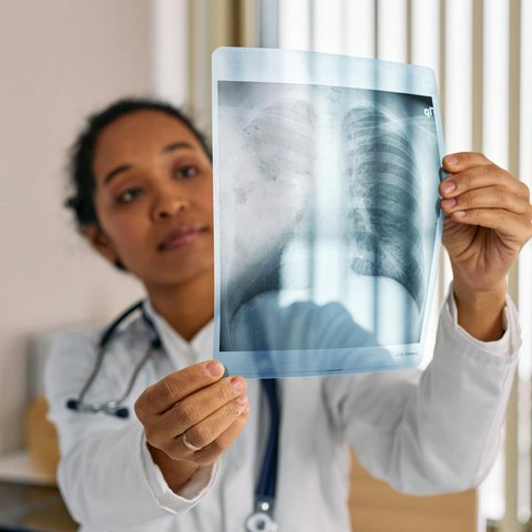 ilustrasi penyakit pneumonia