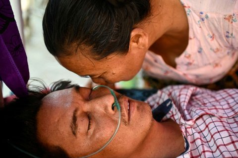 Wajah Tin Maung Htwe tampak lemas setelah lima hari terkubur reruntuhan gempa Myanmar di Sagaing, pada 3 April 2025. Dua hal yang akhirnya menyelamatkan nyawa guru Tin Maung Htwe ketika berhari-hari tertimbun reruntuhan adalah pengetahuan yang pernah dipelajarinya semasa sekolah dan air kencingnya sendiri.