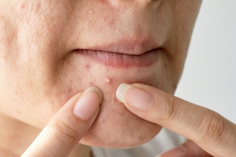 Jangan Dibuang! Ketahui Kandungan Ajaib Kulit Mangga untuk Perawatan Kulit Sehat dan Glowing