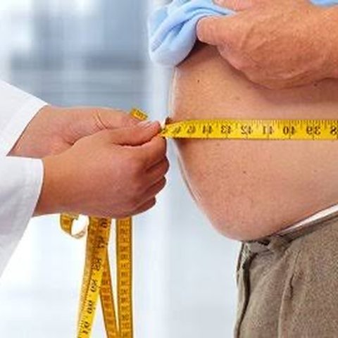 Operasi Bariatrik: Jalan Menuju Kehidupan Sehat bagi Penderita Obesitas Ekstrem