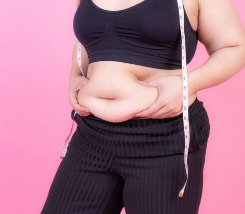 obesitas