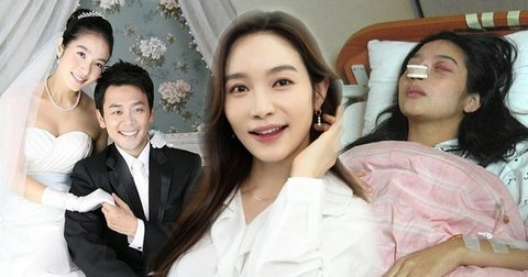 Cinta Kilat yang Kandas, Ini 11 Artis Korea yang Pernikahannya Berakhir Singkat, dari Kim Bo Ra hingga Song-Song Couple