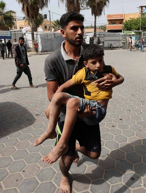 FOTO: Pilu! Anak-Anak Gaza Korban Serangan Udara Israel