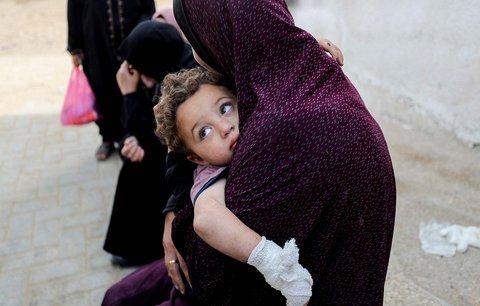 Seorang ibu menggendong anak yang tangannya terluka di rumah sakit Al Shifa, Kota Gaza, 18 Mei 2025. Minggu (18/05/2025).