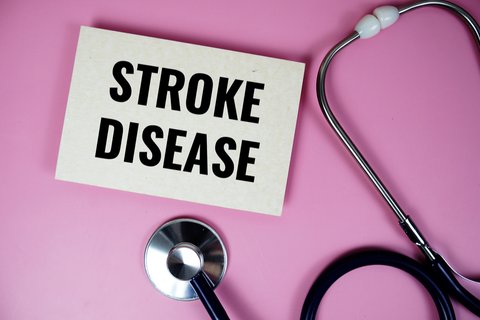 Ilustrasi penyakit stroke.