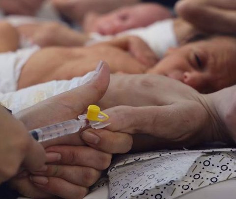 Bayi-bayi di Gaza yang mengalami gizi buruk parah.