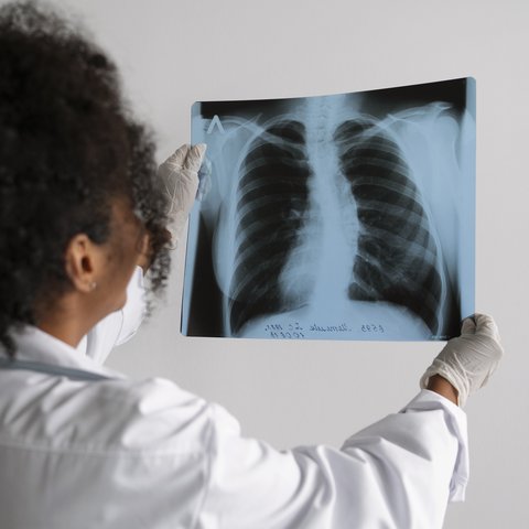 Seorang dokter sedang melihat hasil rontgen paru-paru (Foto Dok: Freepik/freepik).