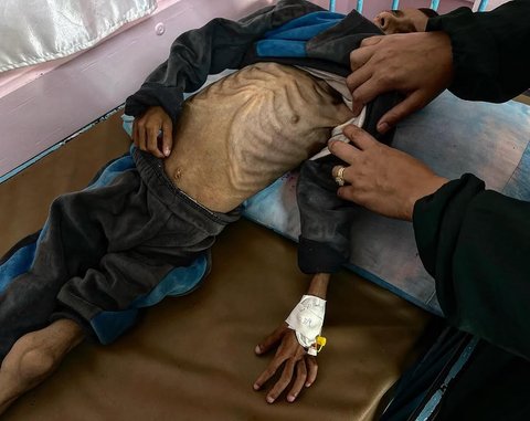 anak gaza kelaparan