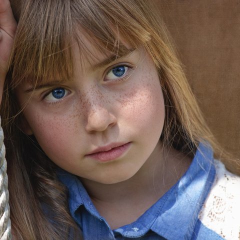 Waspadai Freckles di Wajah: Simbol Kecantikan atau Sinyal Masalah Kesehatan? Ini Penjelasan Medisnya
