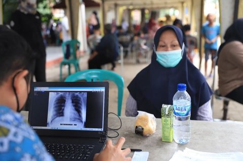 Angka Kasus TBC Indonesia Tertinggi Kedua di Dunia, ini Gejala dan Penyebab yang Harus Diwaspadai