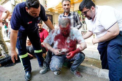 Seorang pria bercucuran darah setelah terluka akibat serangan rudal Israel menghantam Kota Teheran, Iran, pada Minggu (15/6/2025).